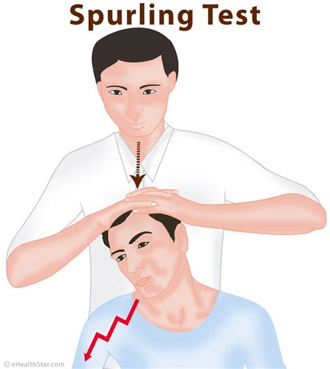 compression test spine|positive spurling sign.